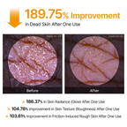 Peel Shot Kojic Acid Turmeric Spray